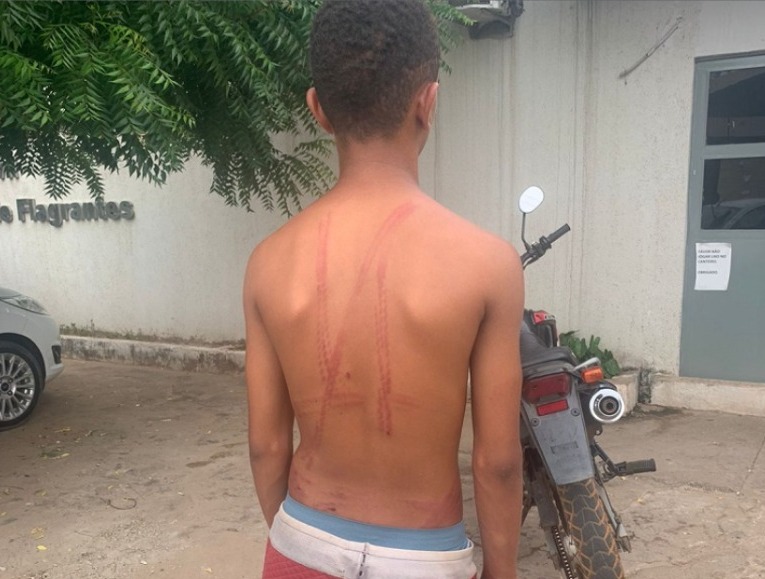 Criança é chicoteada por suspeita de furtar esporas no Piauí. Foto: reprodução  Criança é chicoteada por suspeita de furtar esporas no Piauí. Foto: reprodução