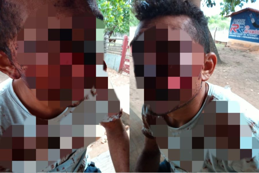 Homem sobrevive após levar tiros no rosto durante assalto no Norte do Piauí. Foto: reprodução  Homem sobrevive após levar tiros no rosto durante assalto no Norte do Piauí. Foto: reprodução