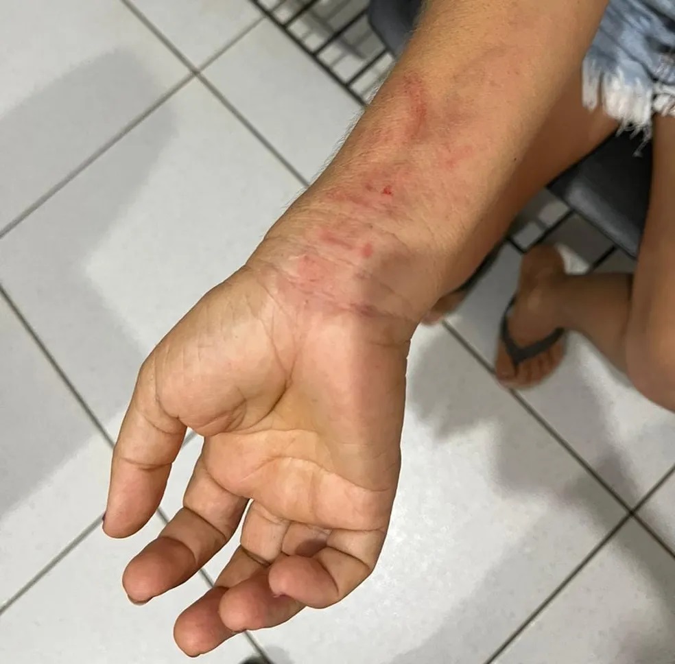 Mulher fica oito meses em cárcere privado no Norte do Piauí. Foto: reprodução  Mulher fica oito meses em cárcere privado no Norte do Piauí. Foto: reprodução